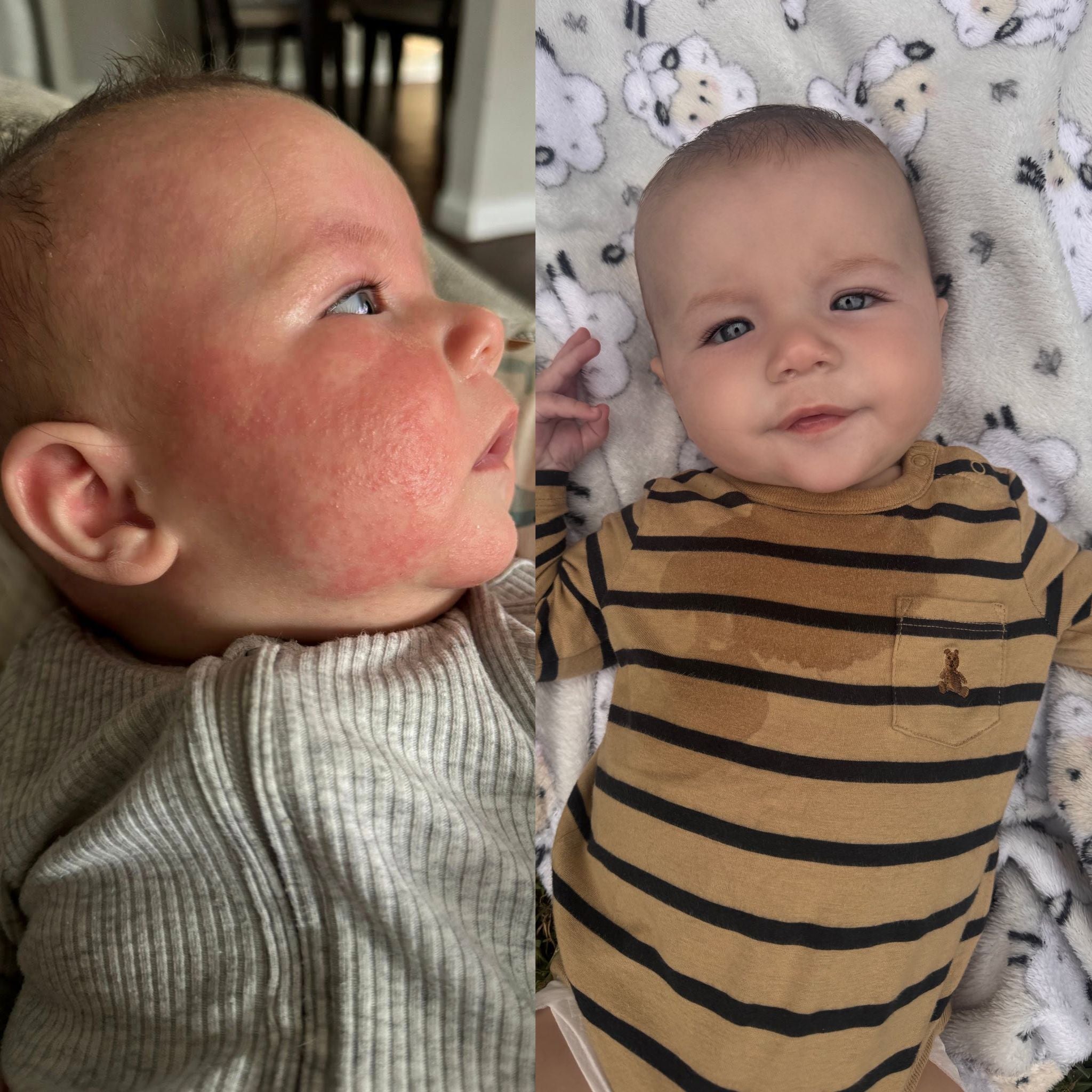 Sweet Lil Ones™ - Eczema-Friendly Crib Sheets